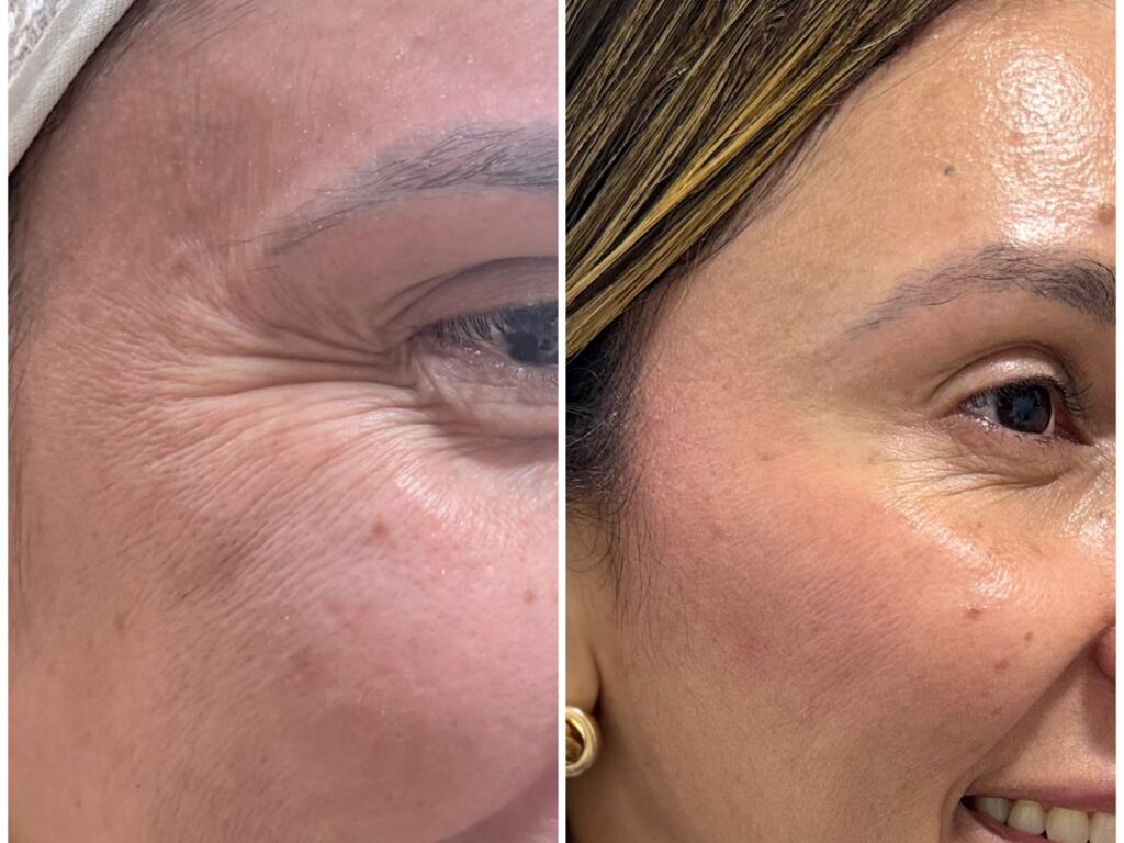 Estética img 20260520 wa0039